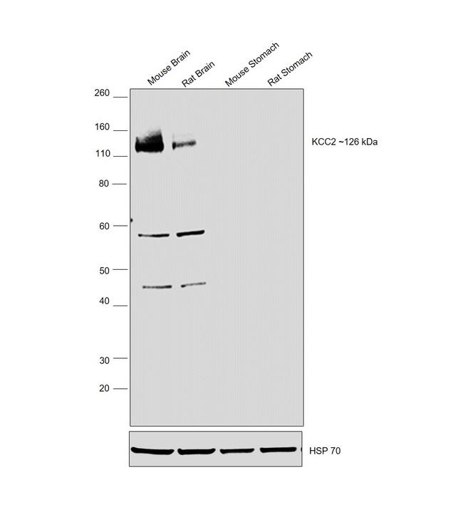 KCC2 Antibody in Western Blot (WB)