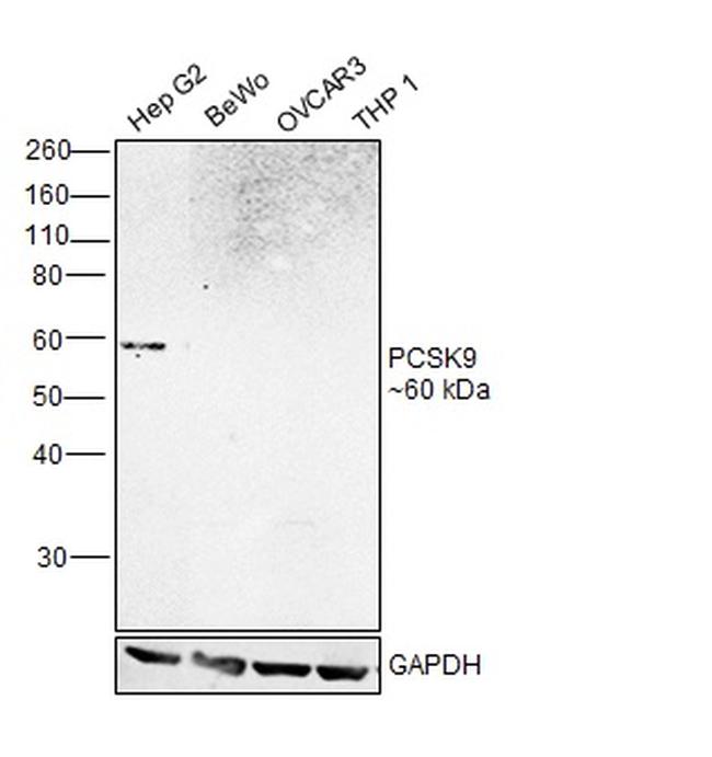 PCSK9 Antibody in Western Blot (WB)