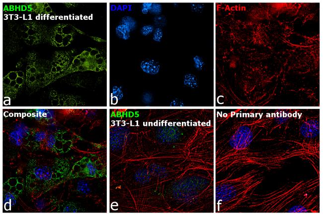 ABHD5 Antibody