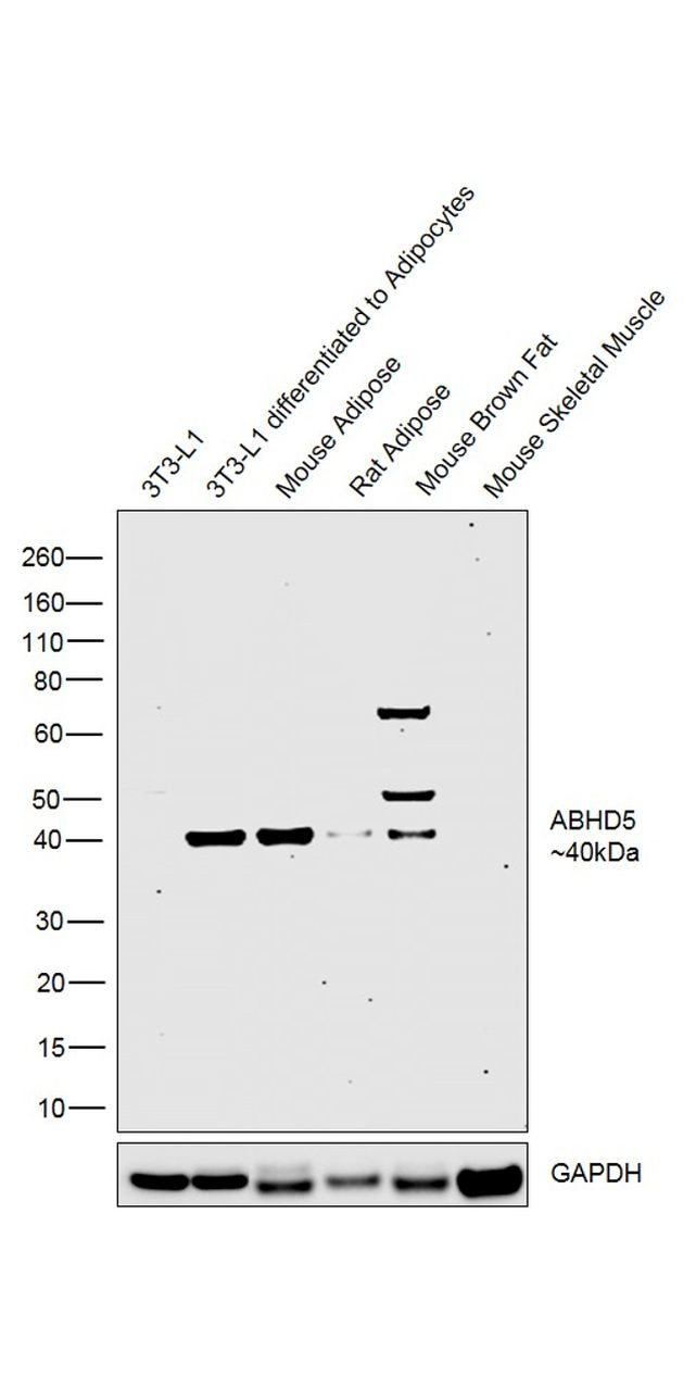 ABHD5 Antibody