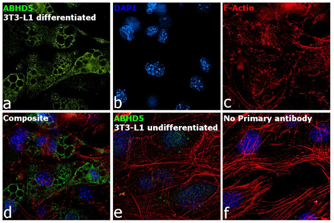 ABHD5 Antibody in Immunocytochemistry (ICC/IF)