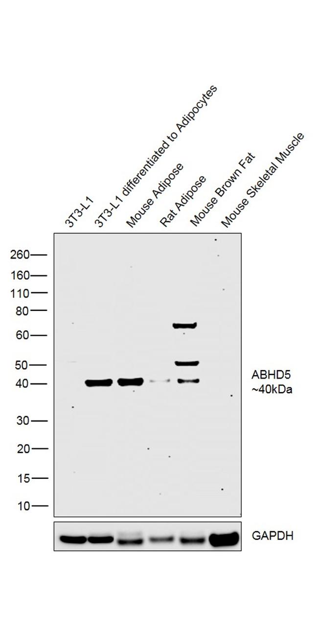 ABHD5 Antibody in Western Blot (WB)