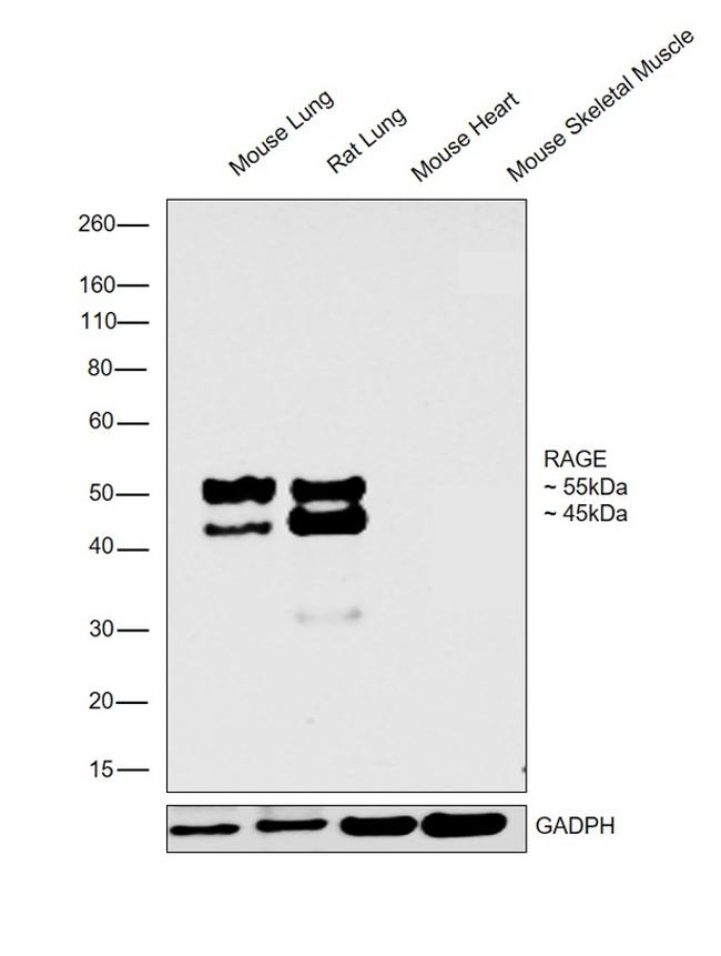 RAGE Antibody in Western Blot (WB)