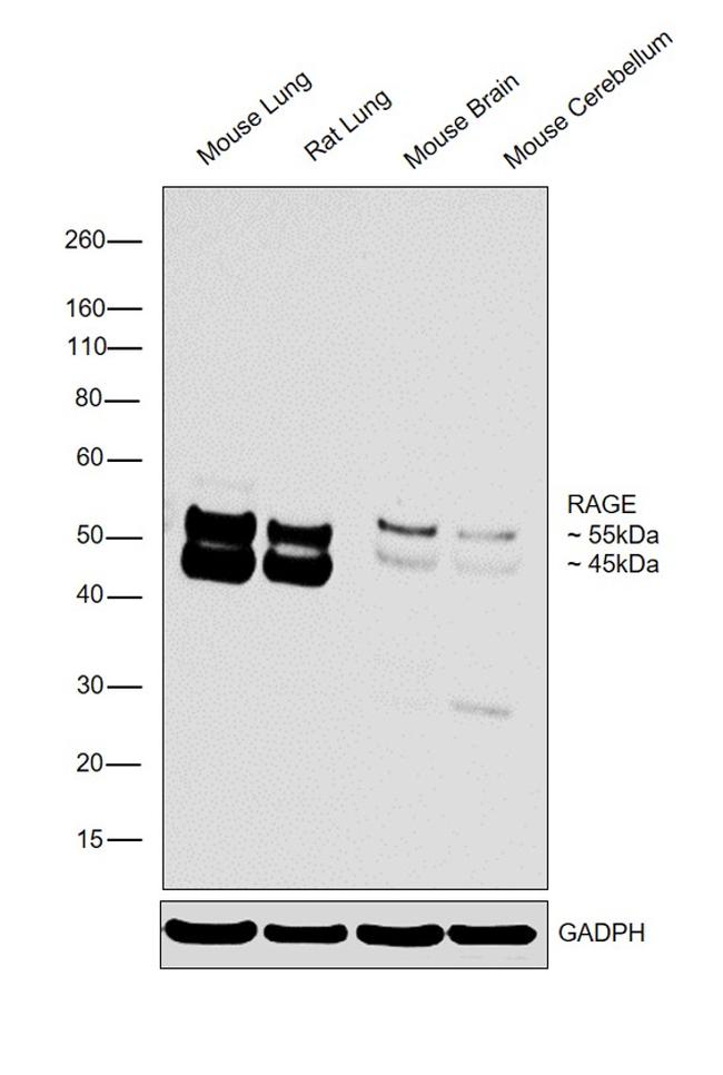 RAGE Antibody in Western Blot (WB)