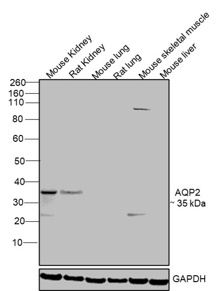 Aquaporin 2 Antibody