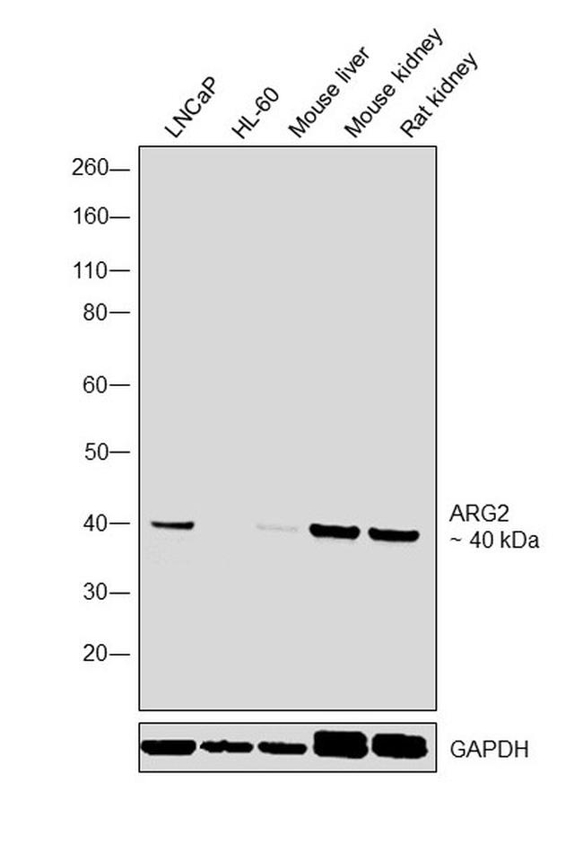 Arginase 2 Antibody in Western Blot (WB)