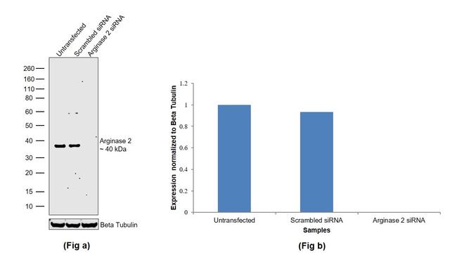 Arginase 2 Antibody in Western Blot (WB)