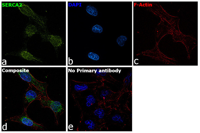 SERCA2 ATPase Antibody in Immunocytochemistry (ICC/IF)