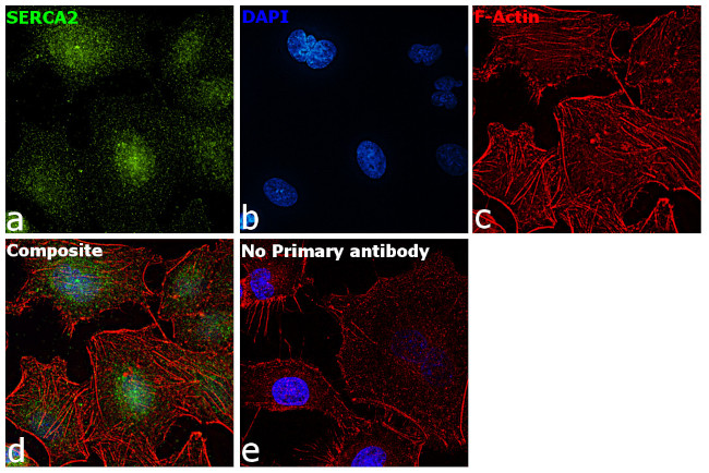 SERCA2 ATPase Antibody in Immunocytochemistry (ICC/IF)