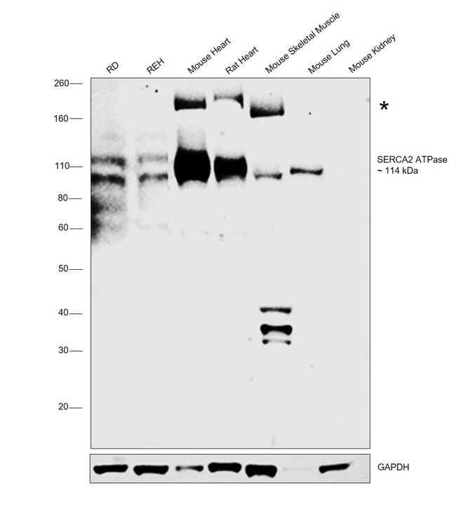 SERCA2 ATPase Antibody in Western Blot (WB)