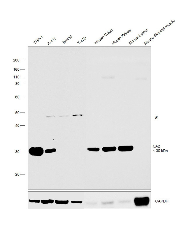 Carbonic Anhydrase II Antibody