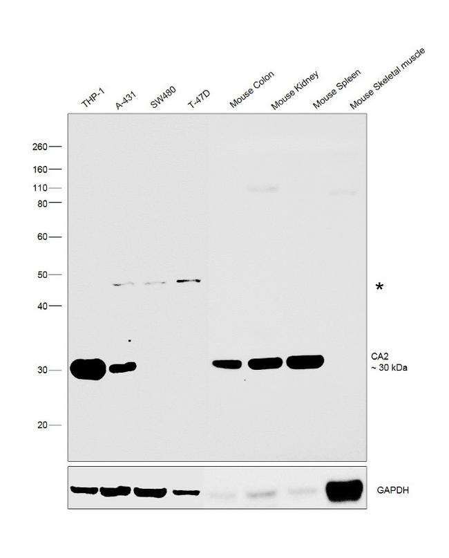 Carbonic Anhydrase II Antibody in Western Blot (WB)