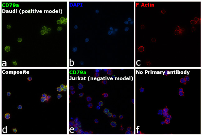 CD79a Antibody