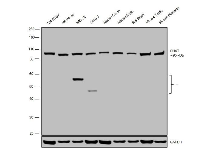 ChAT Antibody in Western Blot (WB)