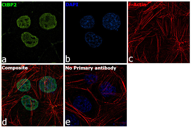 CtBP2 Antibody in Immunocytochemistry (ICC/IF)