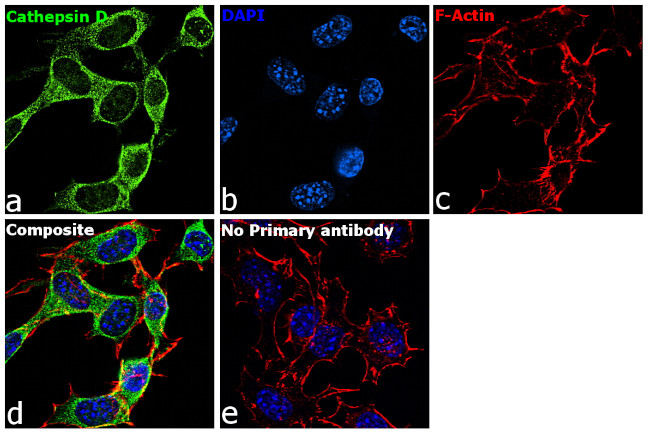 Cathepsin D Antibody in Immunocytochemistry (ICC/IF)