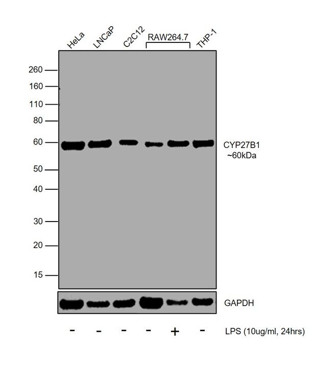 CYP27B1 Antibody in Western Blot (WB)