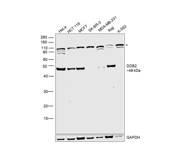 DDB2 Antibody in Western Blot (WB)