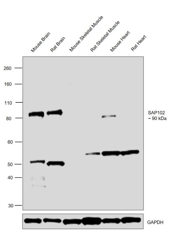 SAP102 Antibody in Western Blot (WB)