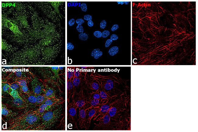 CD26 Antibody in Immunocytochemistry (ICC/IF)