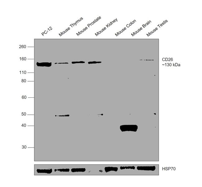 CD26 Antibody in Western Blot (WB)