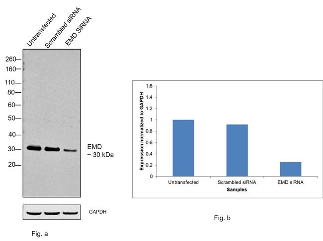 Emerin Antibody in Western Blot (WB)