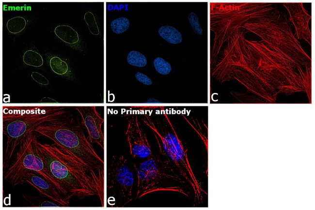 Emerin Antibody in Immunocytochemistry (ICC/IF)