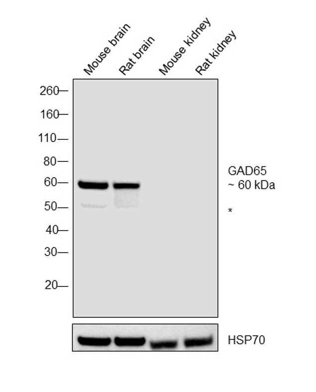 GAD65 Antibody