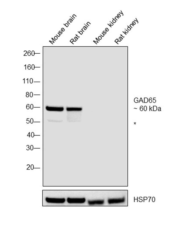 GAD65 Antibody in Western Blot (WB)