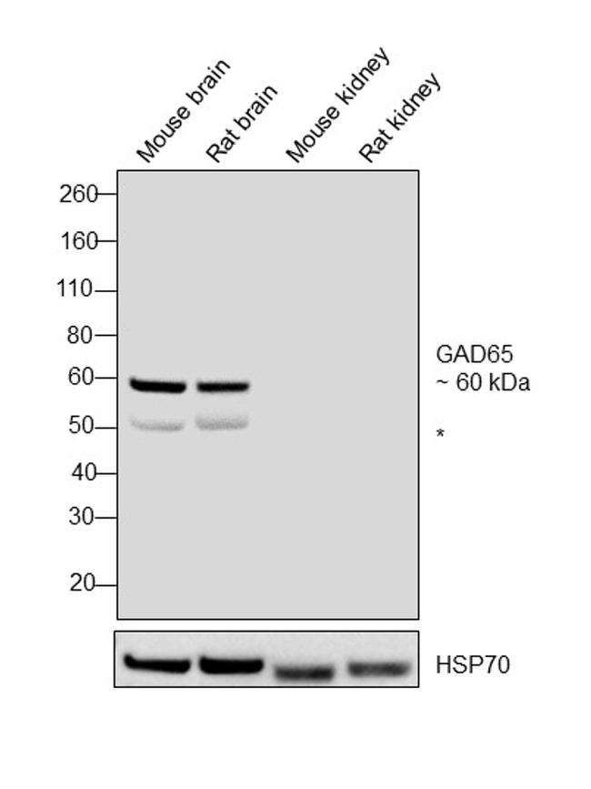 GAD65 Antibody in Western Blot (WB)