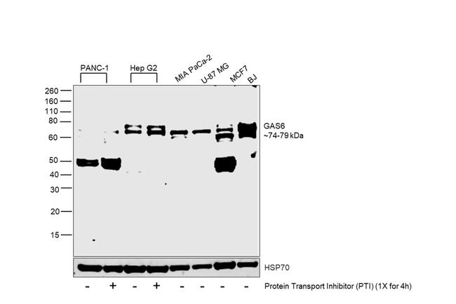 GAS6 Antibody in Western Blot (WB)