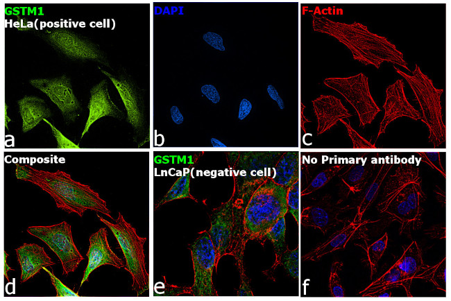 GSTM1 Antibody