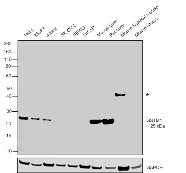 GSTM1 Antibody