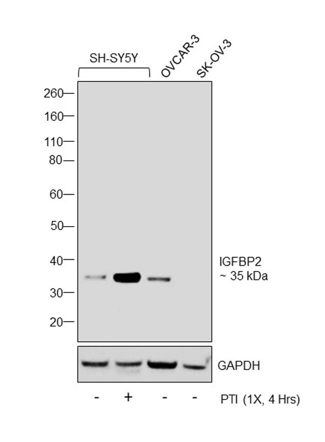 IGFBP2 Antibody in Western Blot (WB)