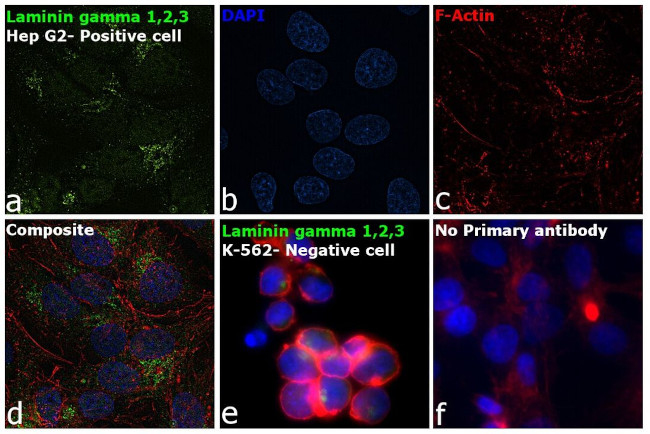 Laminin gamma-1,2,3 Antibody in Immunocytochemistry (ICC/IF)