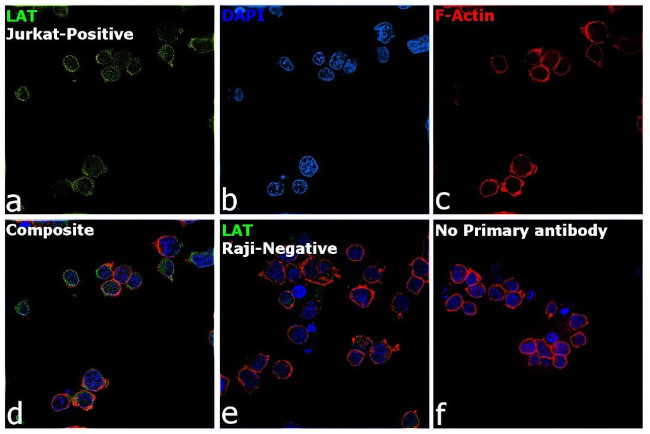 LAT Antibody in Immunocytochemistry (ICC/IF)