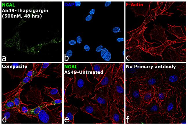 NGAL Antibody