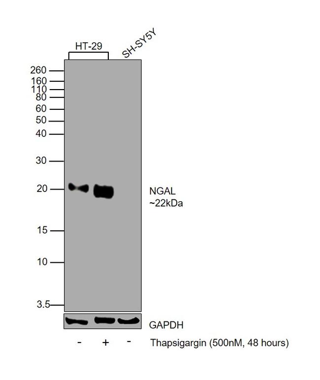 NGAL Antibody in Western Blot (WB)