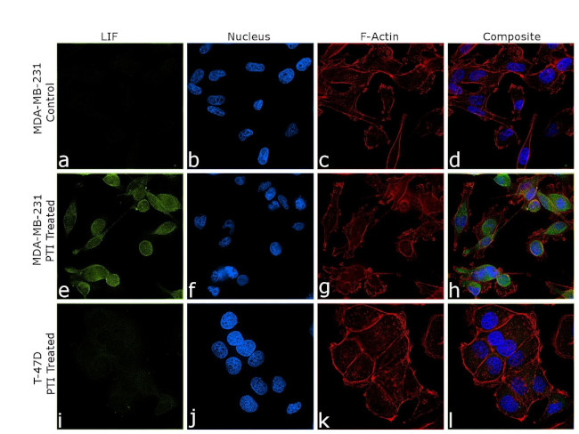 LIF Antibody in Immunocytochemistry (ICC/IF)