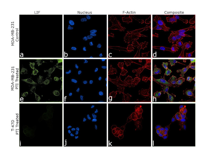 LIF Antibody in Immunocytochemistry (ICC/IF)