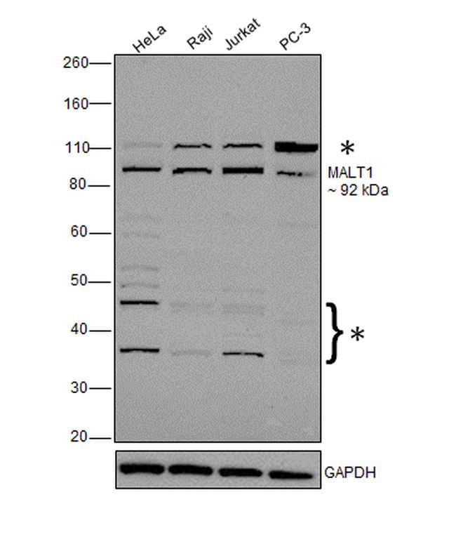 MALT1 Antibody in Western Blot (WB)