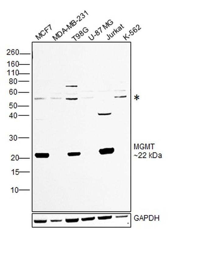 MGMT Antibody in Western Blot (WB)