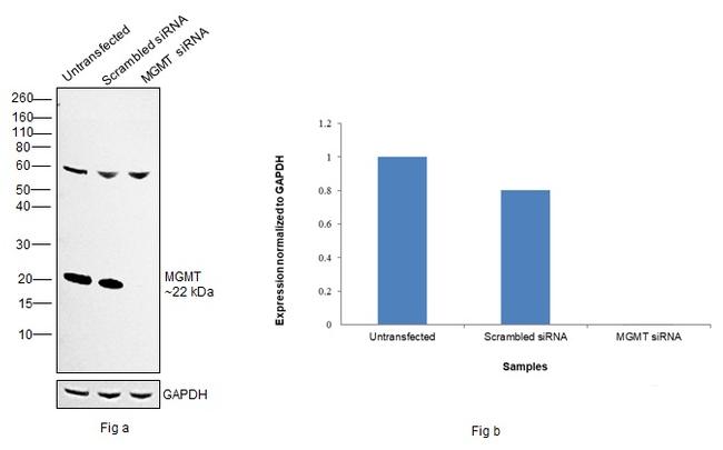 MGMT Antibody in Western Blot (WB)