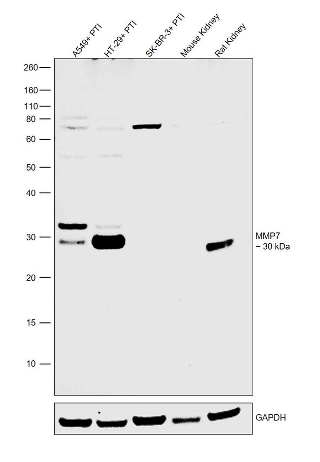 MMP7 Antibody in Western Blot (WB)