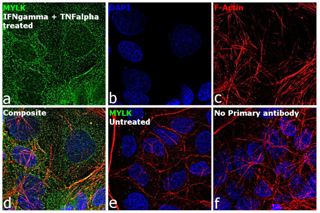 MYLK Antibody in Immunocytochemistry (ICC/IF)