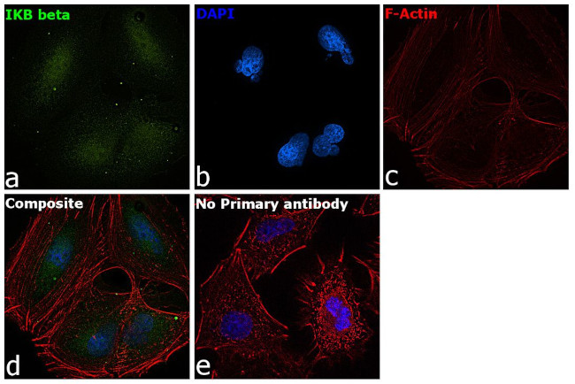 IkB beta Antibody in Immunocytochemistry (ICC/IF)