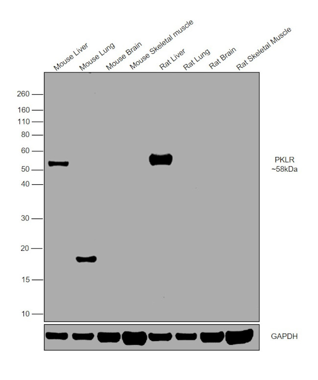 PKLR Antibody