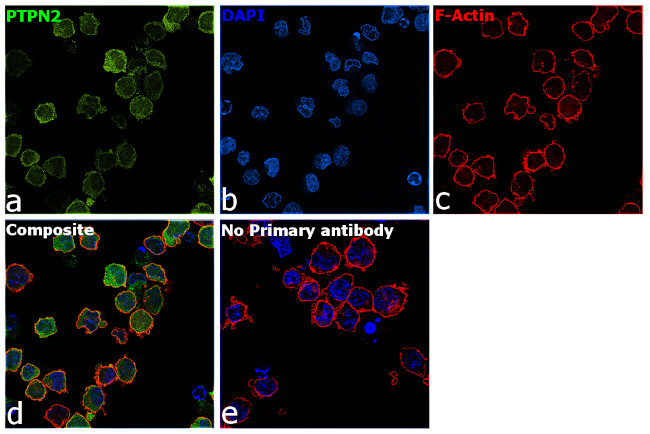 PTPN2 Antibody in Immunocytochemistry (ICC/IF)