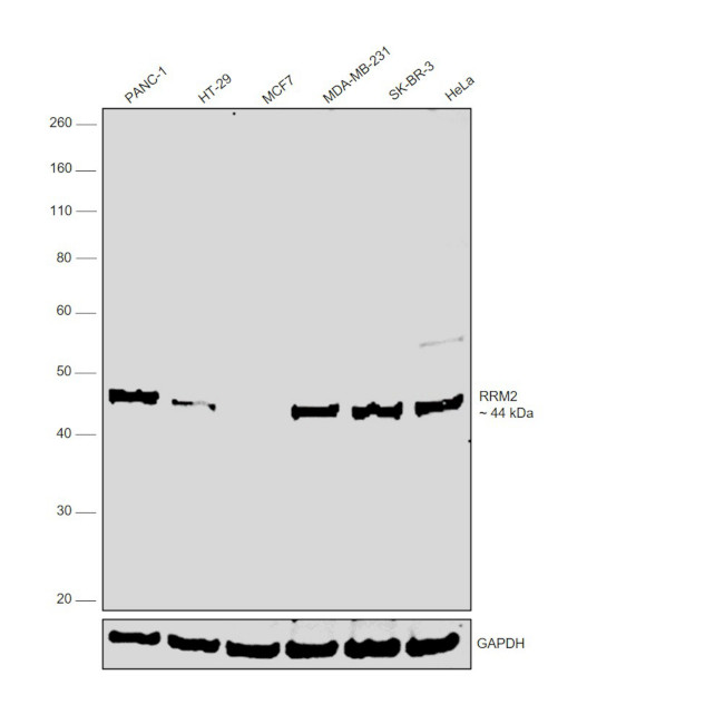 RRM2 Antibody