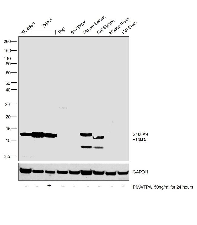 S100A9 Antibody in Western Blot (WB)